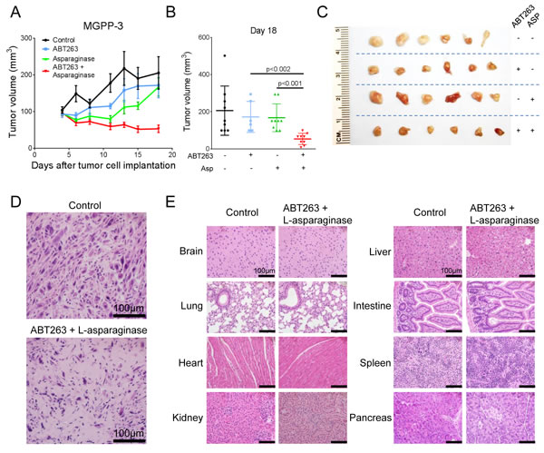 Figure 6: Combined treatment with L-asparaginase (Asp) and ABT263 yields enhanced anti-tumorigenic efficacy  in vivo.